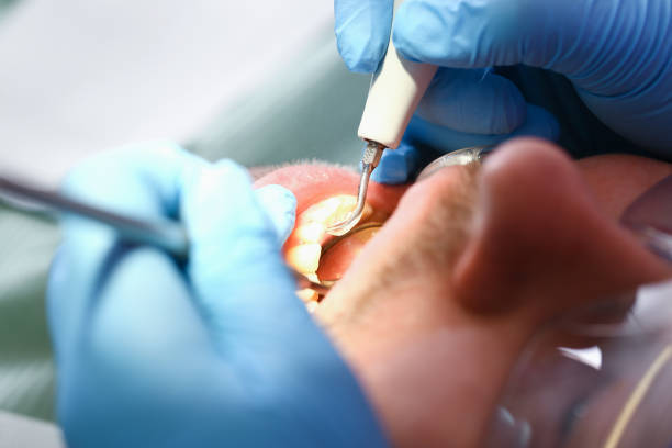 Best Dental Abscess Treatment in Lakin, KS